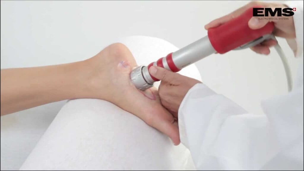 Shockwave therapy clearance for heel pain